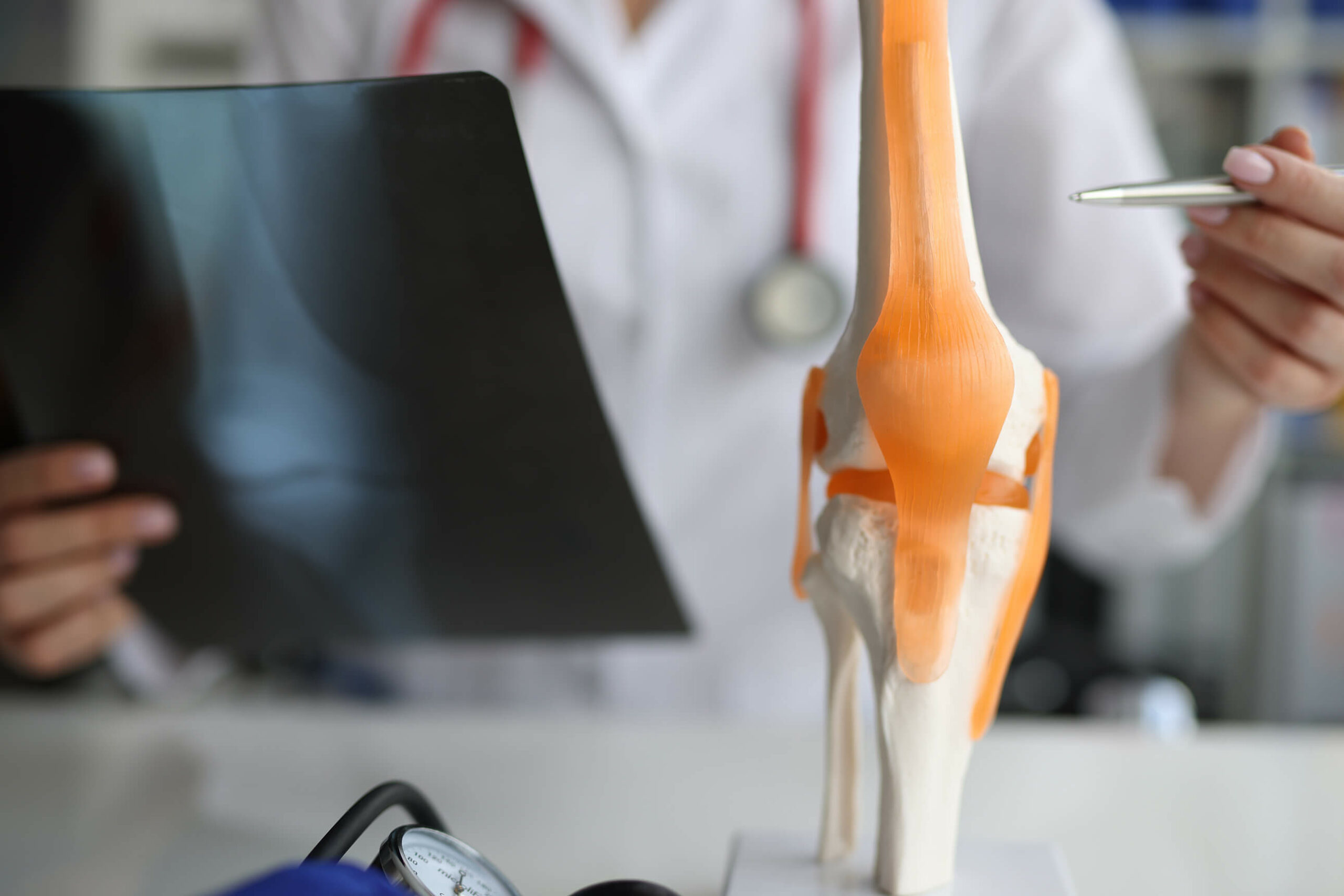 Ein Arzt zeigt auf ein künstliches anatomisches Modell eines Knies