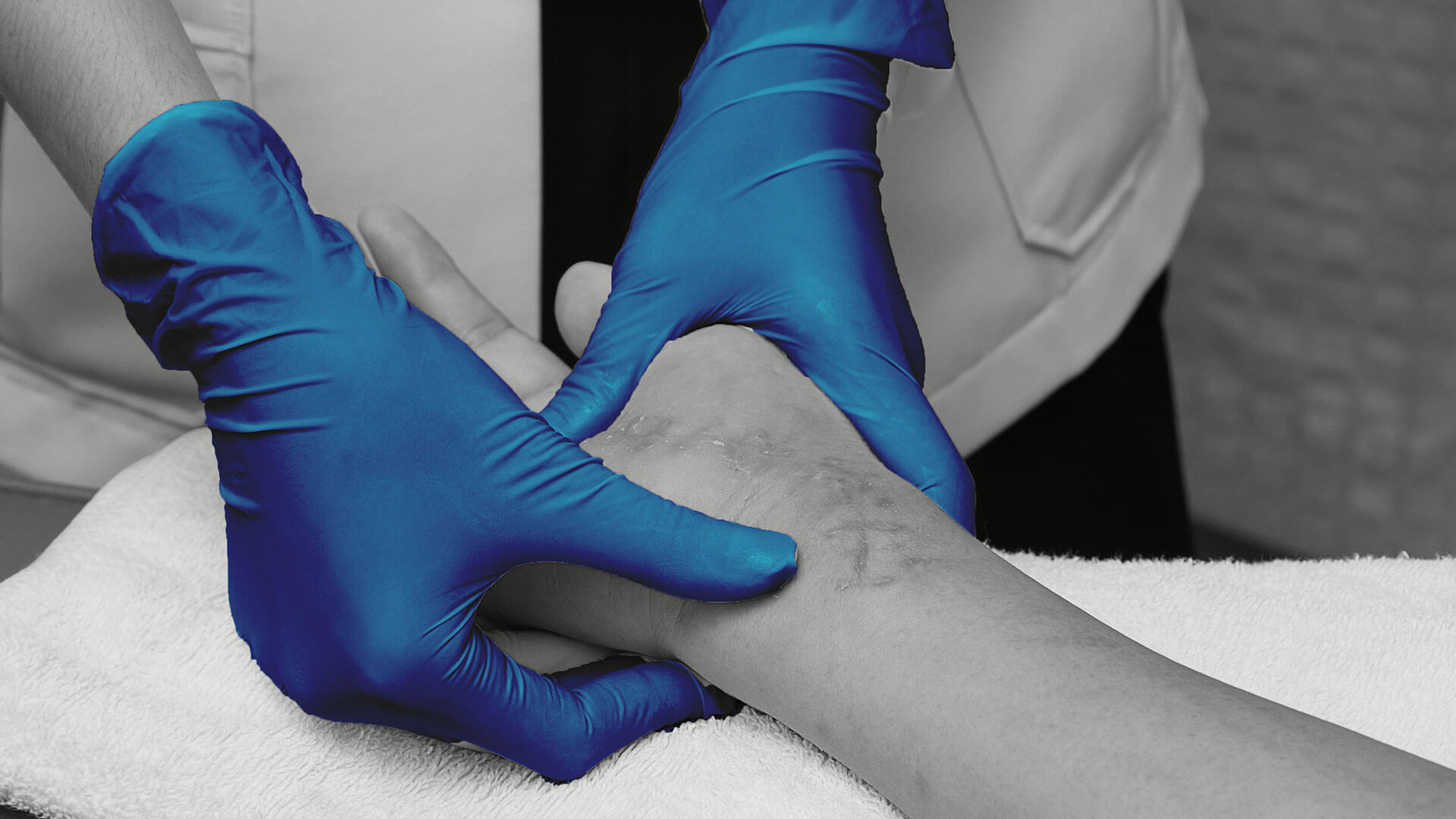 Blaue Handschuhe einer Ärztin bei der Untersuchung eines Unterarmes